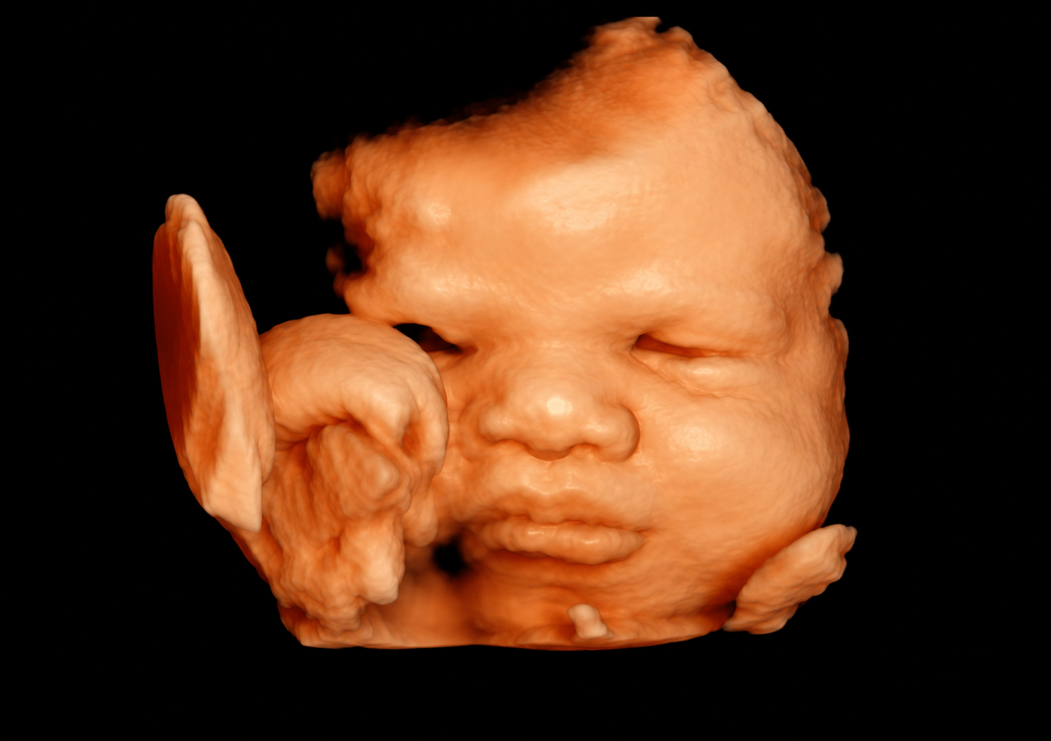 3D/4D ultrasound view of a baby