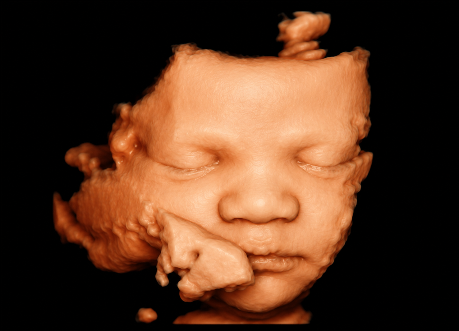 3D/4D ultrasound view of a baby